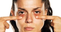 Cách trị thâm mắt siêu hiệu quả lâu năm cũng hết