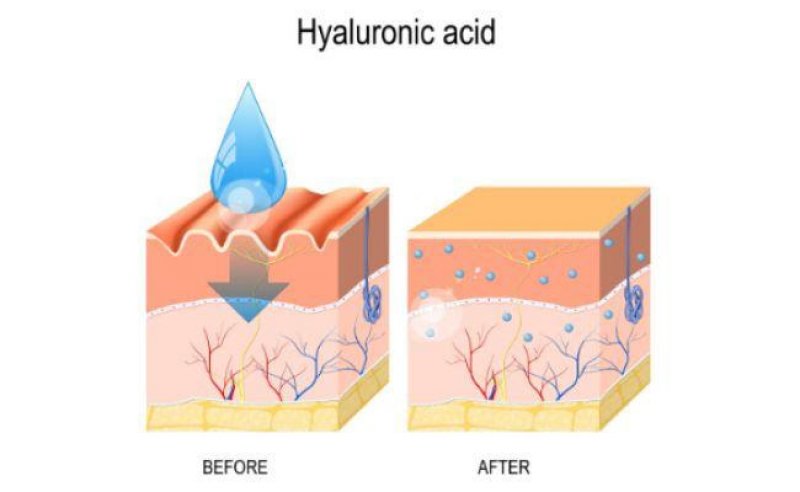 Hyaluronic acid là gì? Tác dụng và lưu ý khi sử dụng cho da 2
