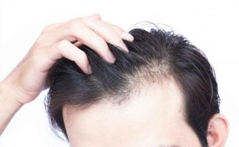12 loại dầu gội ngăn rụng tóc cho nam hiệu quả hàng đầu 0