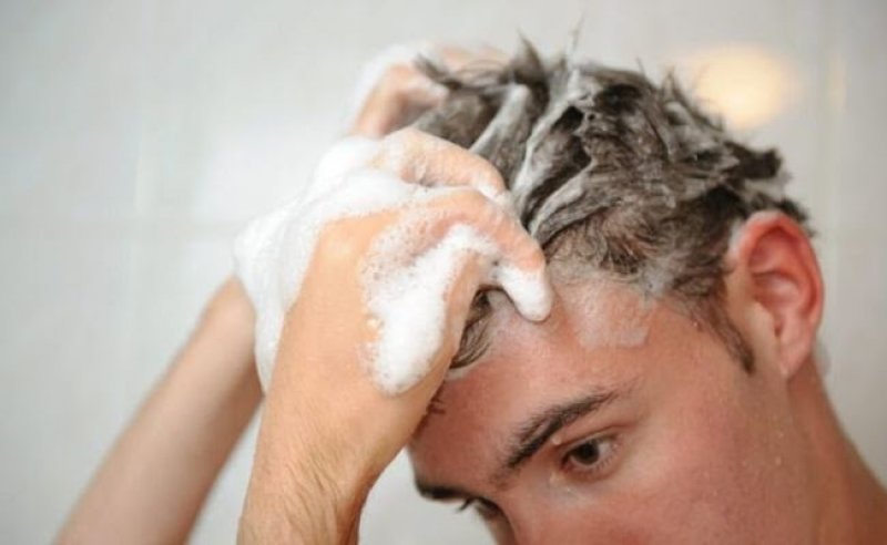 12 loại dầu gội ngăn rụng tóc cho nam hiệu quả hàng đầu 1