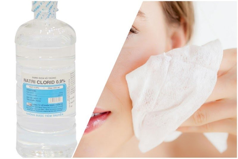 Nước muối sinh lý có thực sự phù hợp để rửa mặt? 4