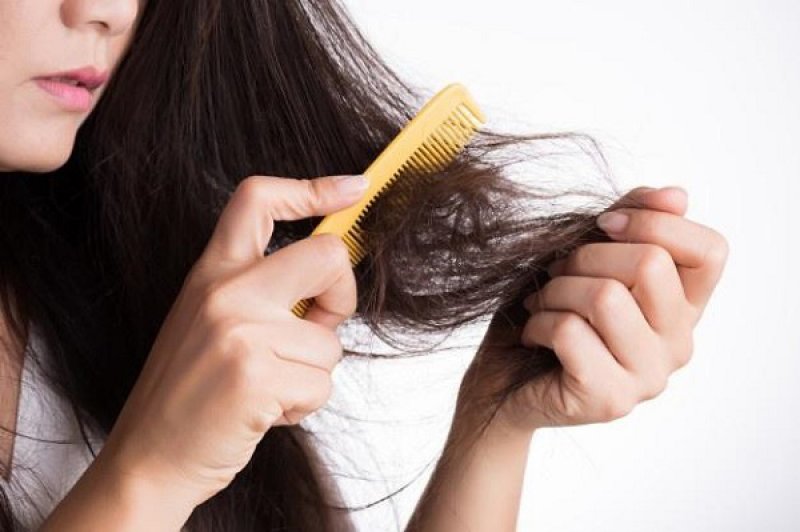 6 nguyên nhân gây rụng tóc và cách giảm rụng tóc【Hiệu quả】 0