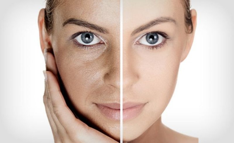 Đi spa chăm sóc da mặt có tốt không? có cần thiết hay không? 1